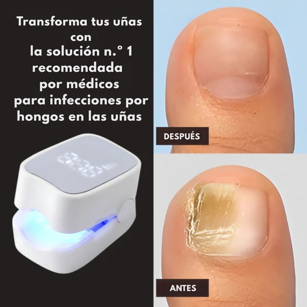 NAILTHERAPY LÁSER
